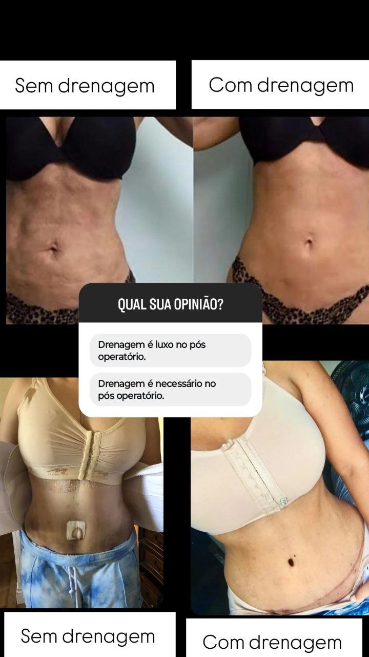 Pós-Operatório 6